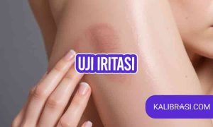 uji iritasi