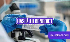 hasil uji benedict