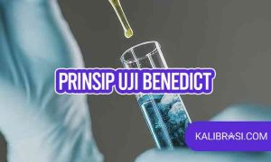 prinsip uji benedict