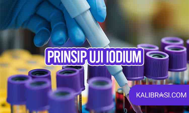 prinsip uji iodium