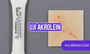 uji akrolein
