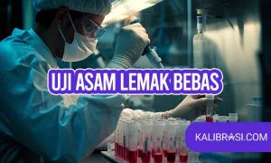 Uji Asam Lemak bebas