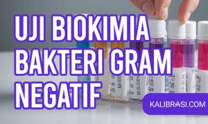 uji bakteri gram negatif