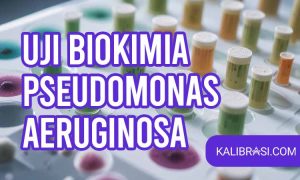 uji biokimia pseudomonas aeruginosa