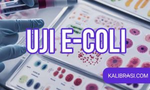 uji e. coli