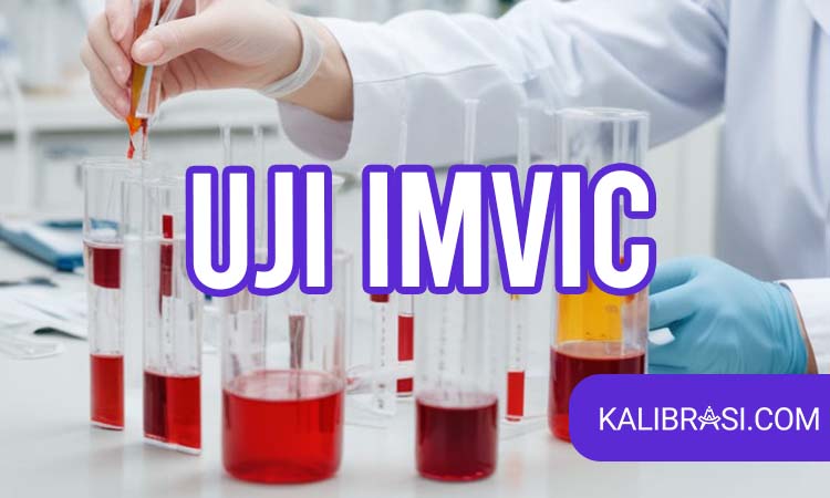 uji imvic
