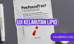Uji kelarutan lipid