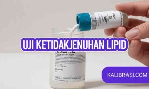 uji ketidakjenuhan lipid