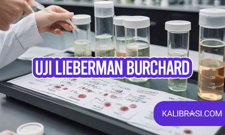 Uji Lieberman Burchard