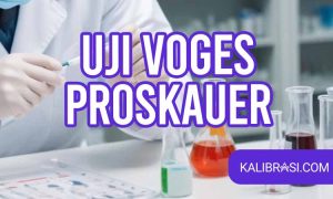 uji voges proskauer